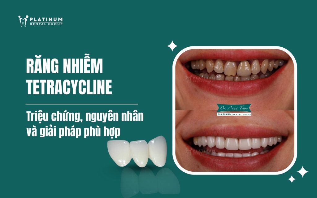 Kinh Nghiệm Chọn Bộ Nhả Kem Đánh Răng Tự Động Phù Hợp Cho Gia Đình.